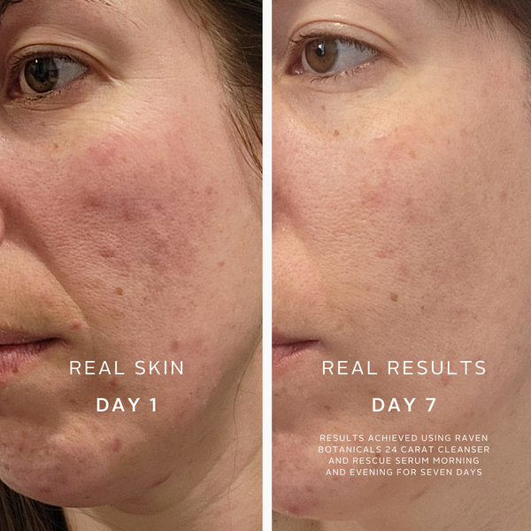 Raven Botanicals | Rescue Serum
